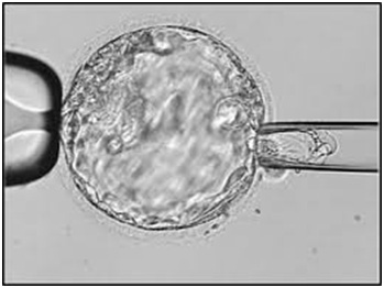 Genetic Screening Tests
